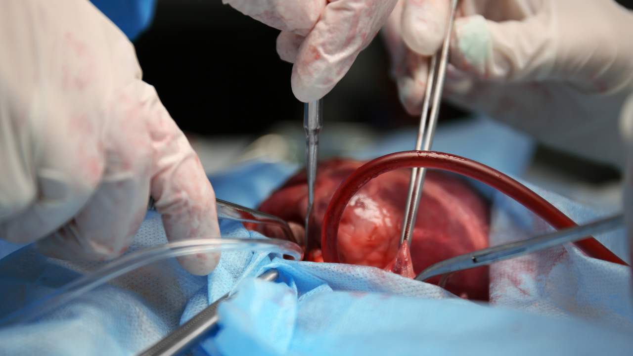 Doctor doing heart operation. Image Credit: Adobe Stock Images/Africa Studio