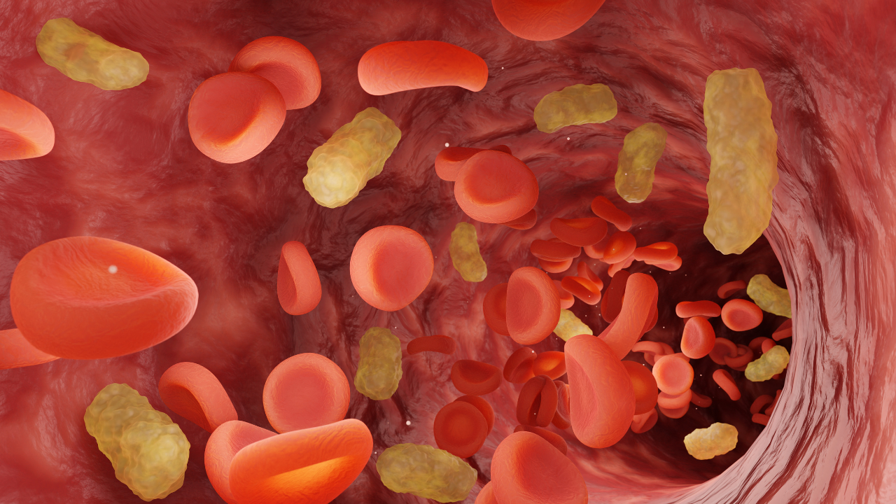 Red blood cells and yellow bacteria flowing in blood vessel. Illustration of the concept of a severe medical condition sepsis in which bacteria enter the blood. Image Credit: Adobe Stock Images/Dragon Claws