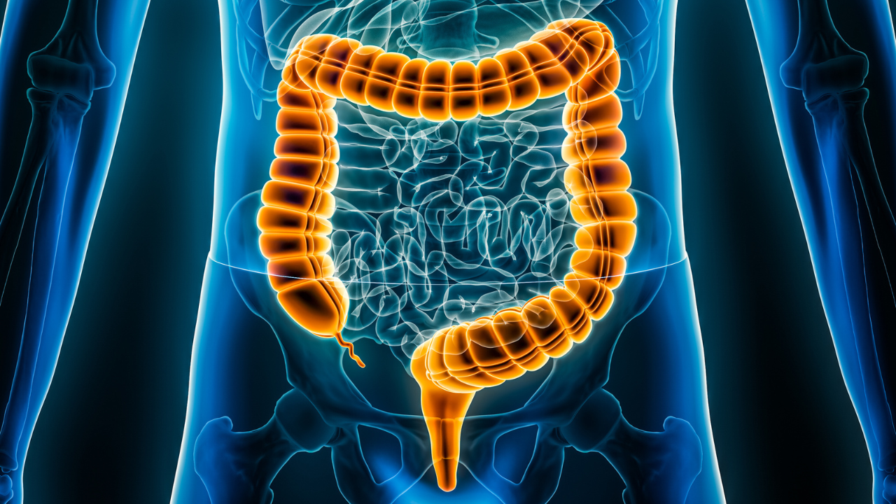 Large intestine or colon or bowels 3D rendering illustration close-up. Irritable bowel syndrome, anatomy, medical, biology, science, healthcare, pathology, inflammatory disease concepts.