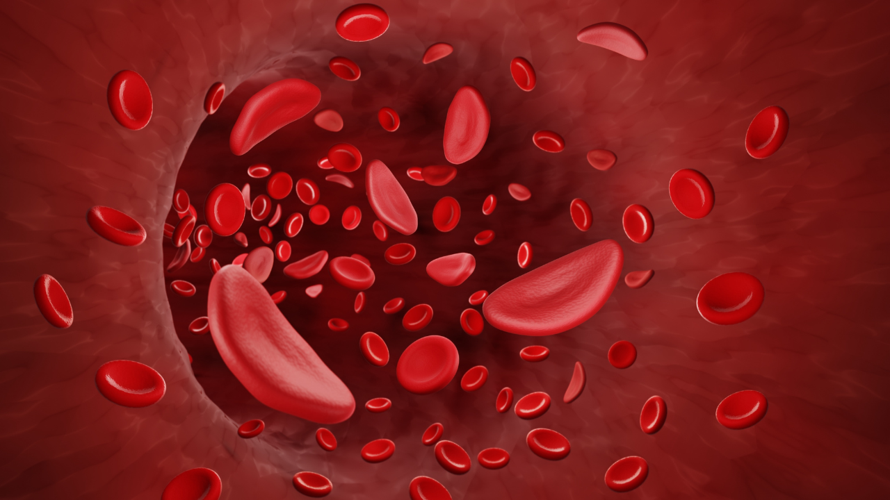Sickle cells in bloodstream. Image Credit: Adobe Stock Images/Artur
