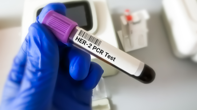 FDA Approves New Herceptin Biosimilar for the Treatment of Multiple HER2-Overexpressing Cancers