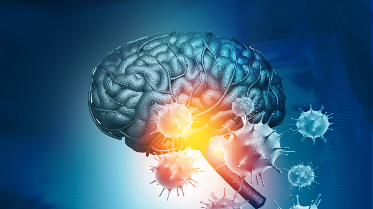 Virus attacking a human brain. 3d illustration. Image Credit: Adobe Stock Images/Rasi