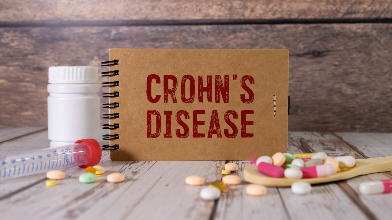 Paper with CROHN'S DISEASE on the office desk, stethoscope and pills, top view. Image Credit: Adobe Stock Images/Uladzislau