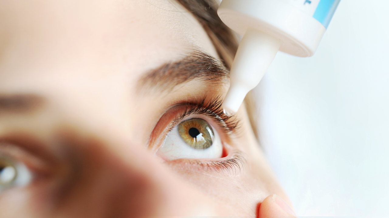 Woman applying eye drop. Vitamin drops from tiredness and redness eyes. Suffering from irritated eye, optical symptoms. Image Credit: Adobe Stock Images/Katarina