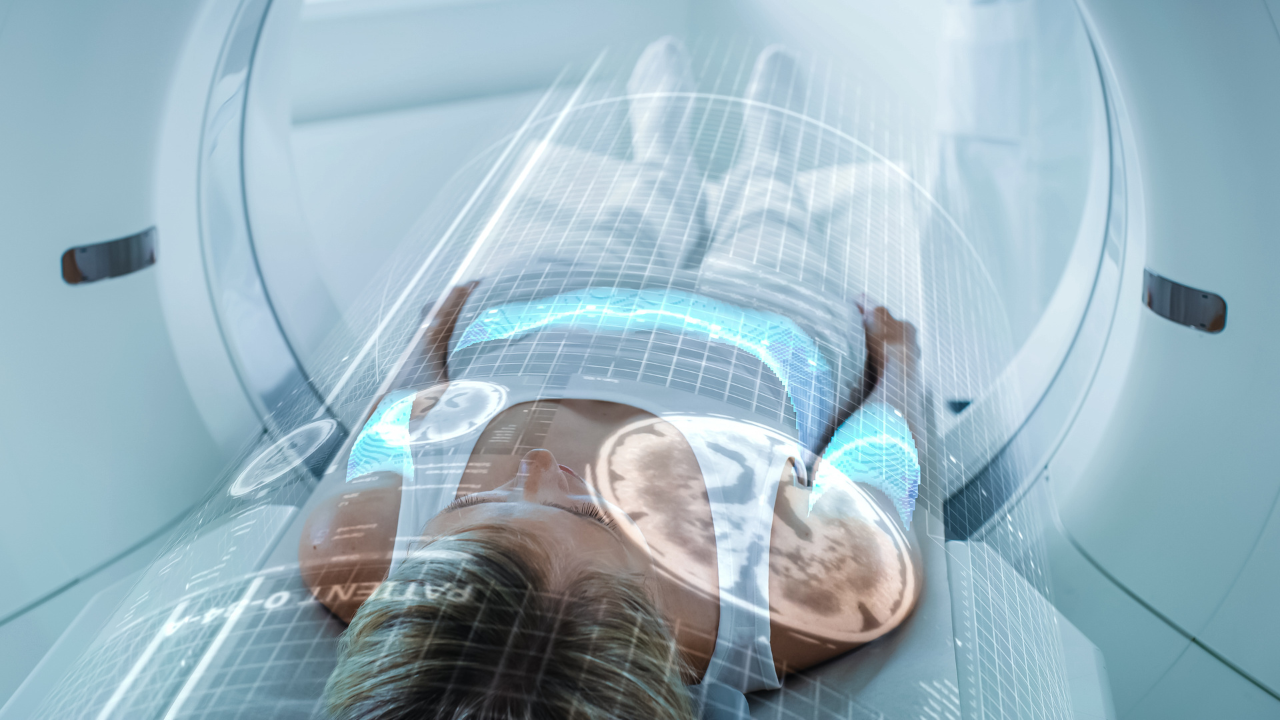 Female Patient Lying in CT or PET or MRI Scan, Moving Inside the Machine While it Scans Her Brain and Vital Parameters. Augmented Reality VFX In Hospital Medical Lab with High-Tech Equipment. Image Credit: Adobe Stock Images/Gorodenkoff