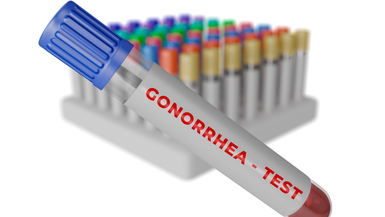 Human blood sample in the tube for gonorrhea test. Image Credit: Adobe Stock Images/AGPhotography
