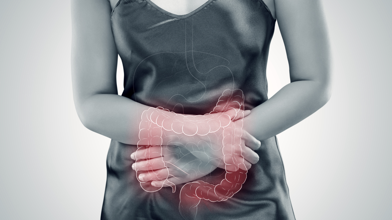 Ulcerative colitis (UC). intestine. Image Credit: Adobe Stock Images/eddows