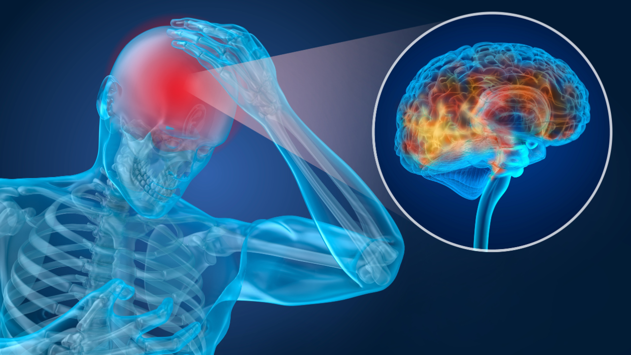 Head pain Attack, man suffering from brain pain. 3D illustration. Image Credit: Adobe Stock Images/Alex Mit