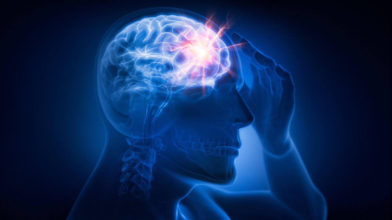 Man with heavy headache - 3D illustration. Image Credit: Adobe Stock Images/peterschreiber.media