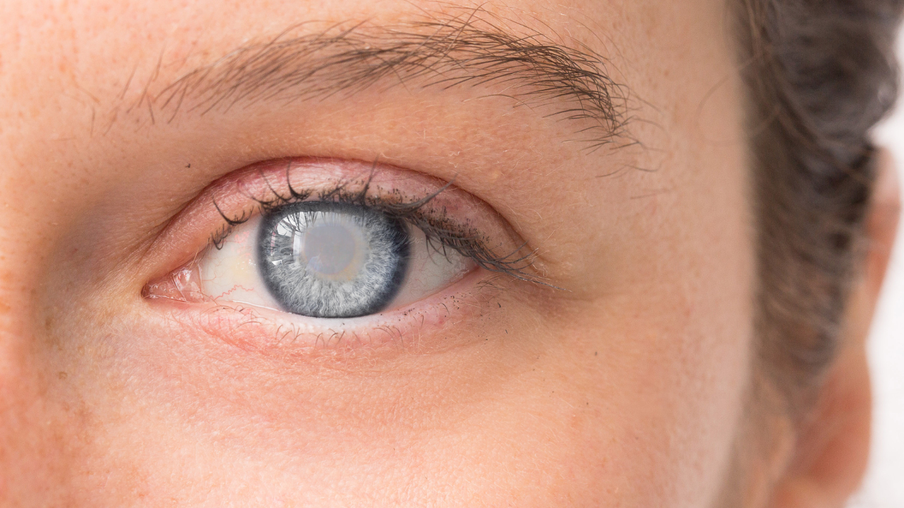 Boehringer Ingelheim, Zeiss Partner on Eye Disease Prevention 