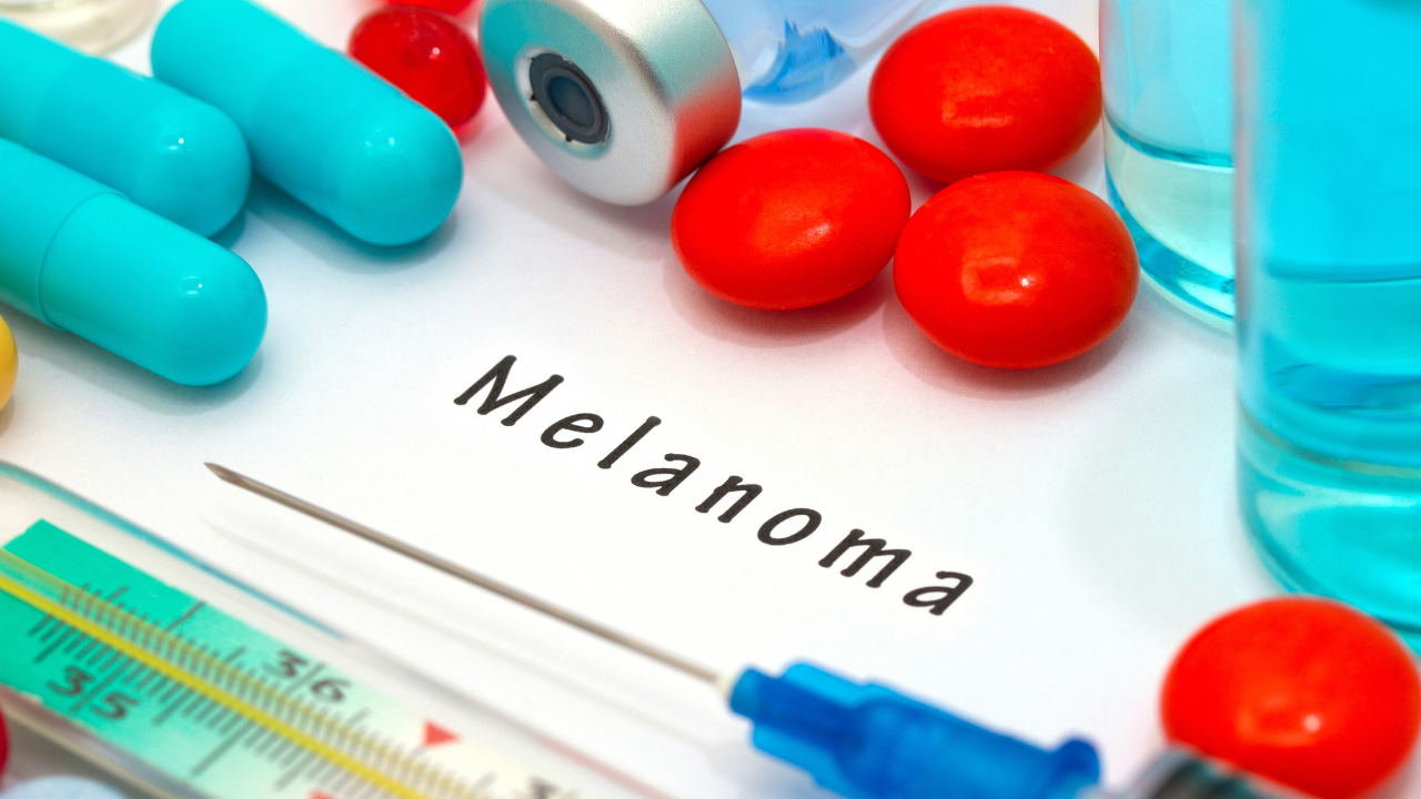 melanoma. Image Credit: Adobe Stock Images/greenapple78