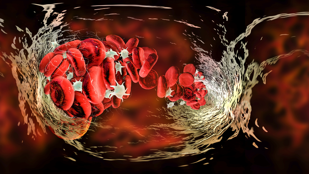 Blood clot, 360 degree panorama view. Image Credit: Adobe Stock Images/Dr_Microbe