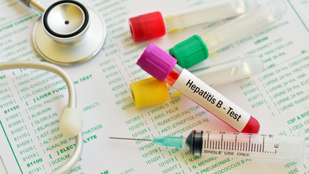 Hepatitis B virus test. Image Credit: Adobe Stock Images/jarun011