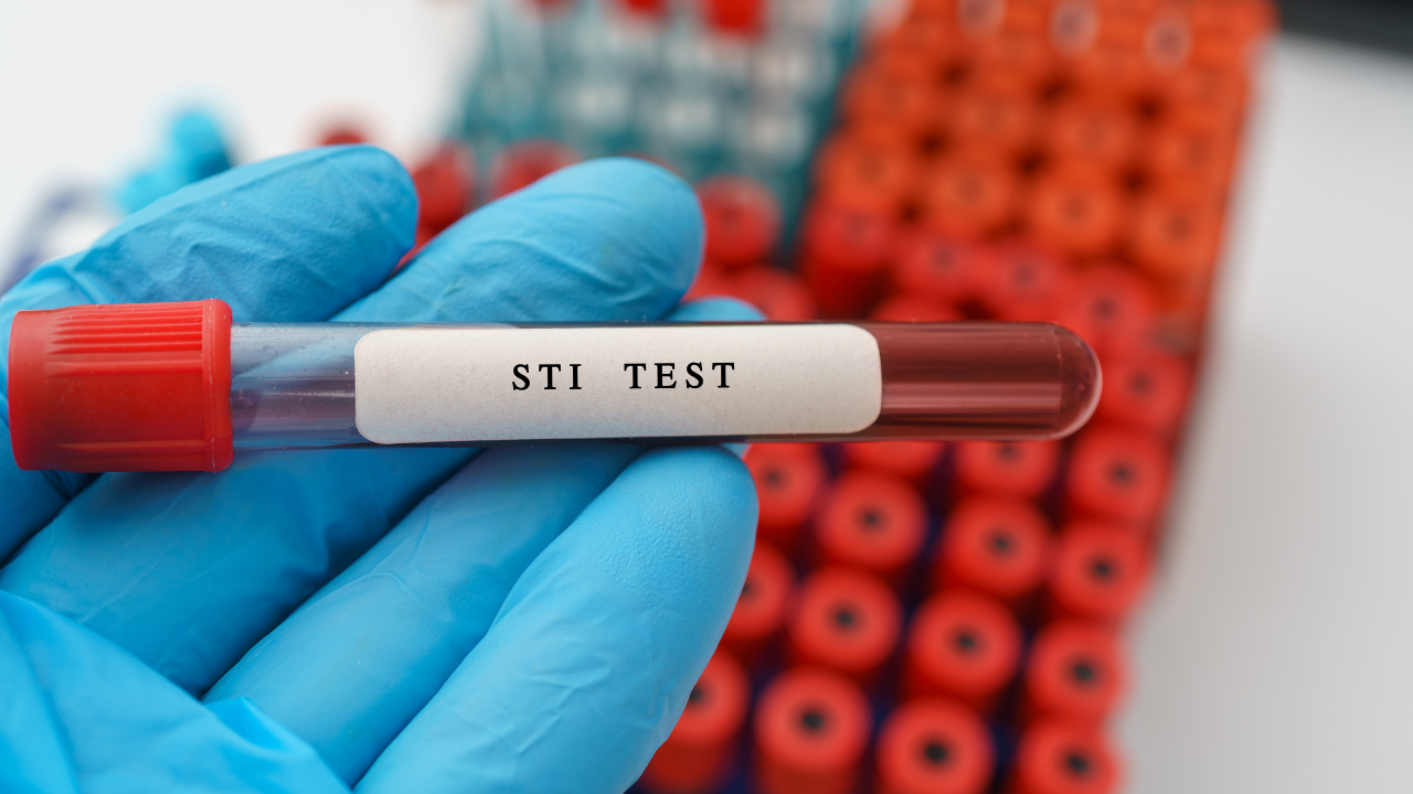 STI (sexually transmitted infection) test result with blood sample in test tube on doctor hand in medical lab. Image Credit: Adobe Stock Images/luchschenF
