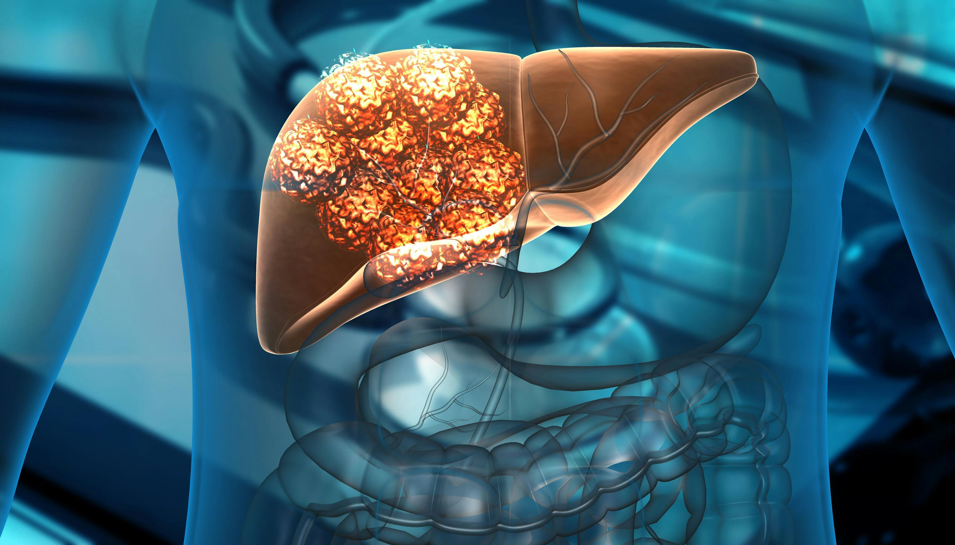 FDA Fast Tracks Biosyngen’s Novel TIL Therapy for All Types of Liver Cancer