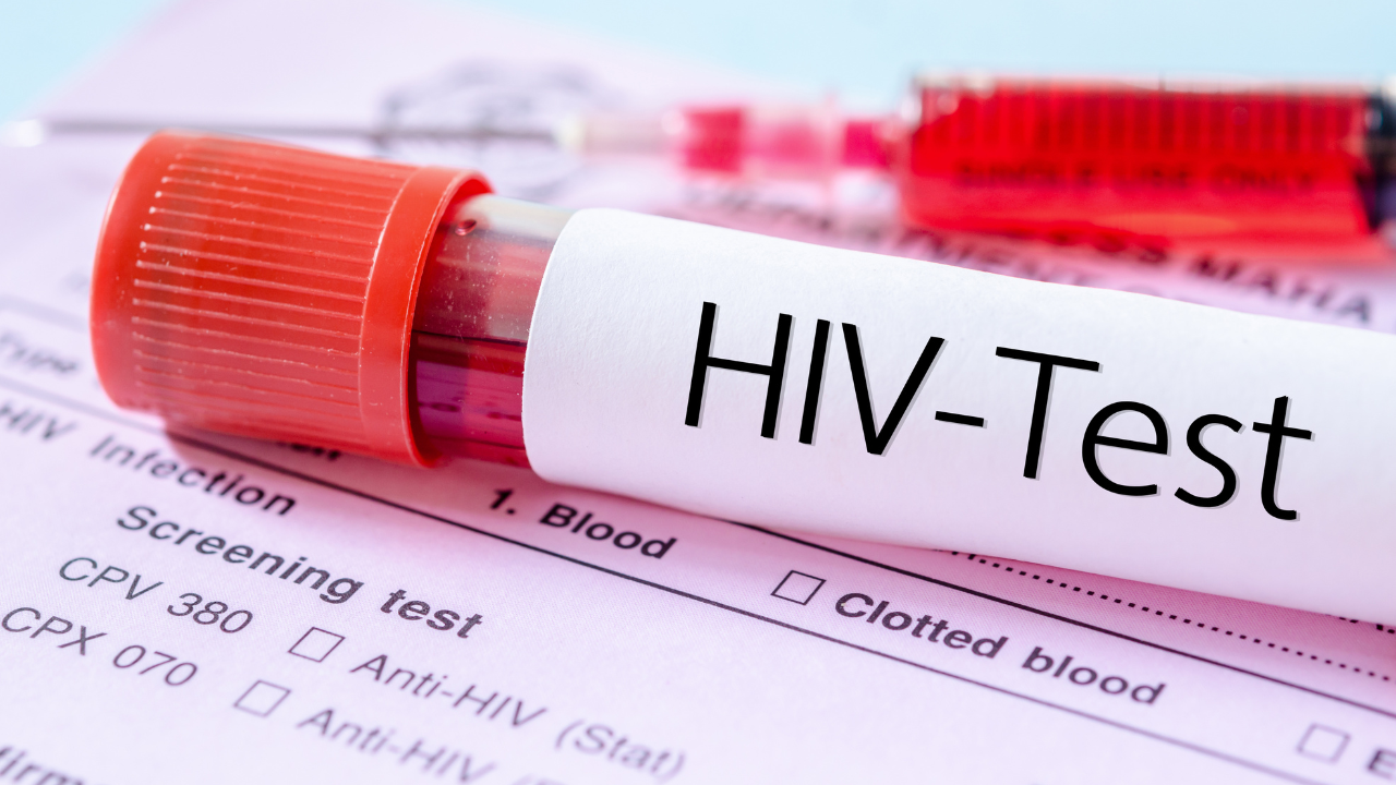 HIV test label on HIV infection screening test form. Image Credit: Adobe Stock Images/gamjai