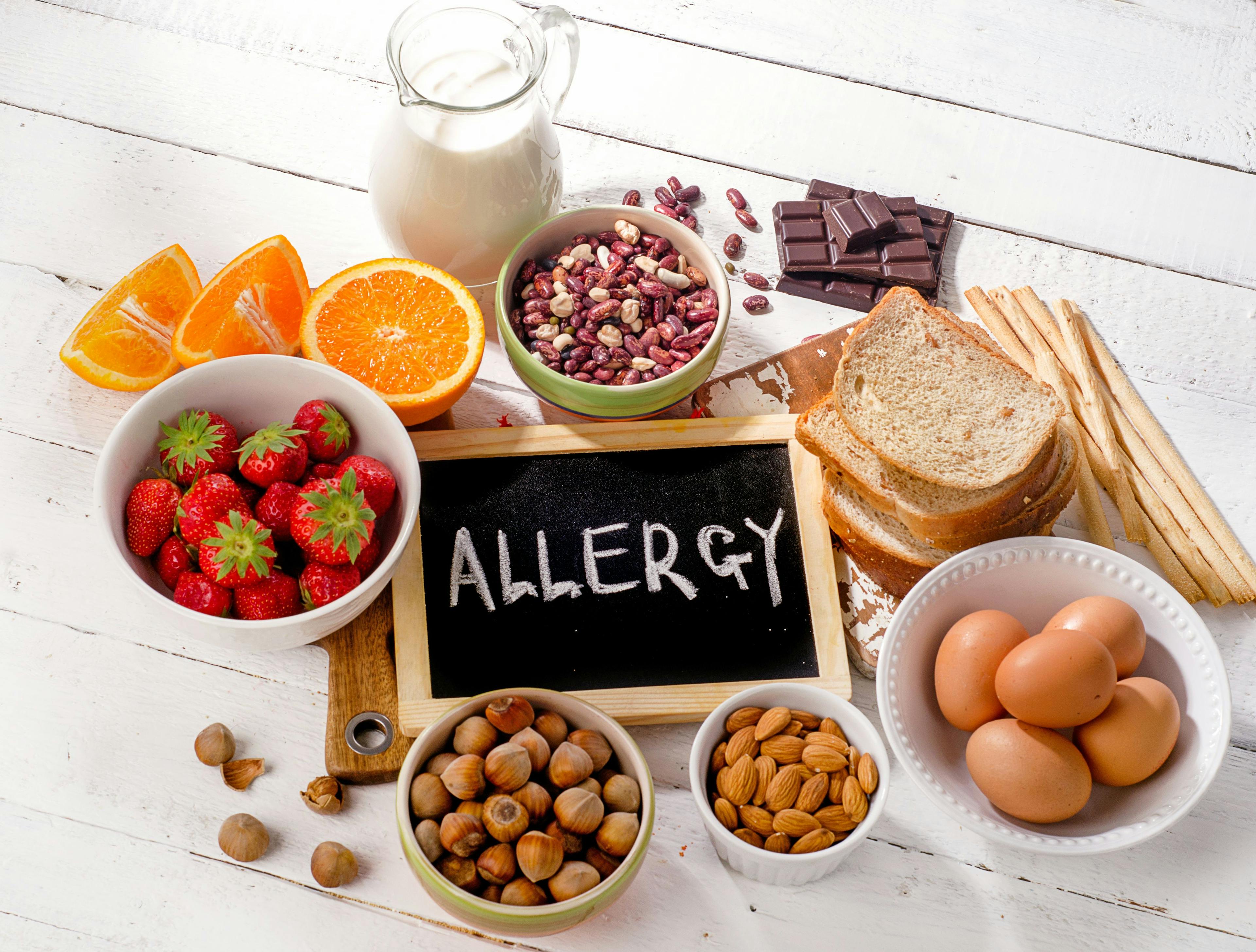 Image credit: bit24 | stock.adobe.com. Food allergy. Allergic food on wooden background.