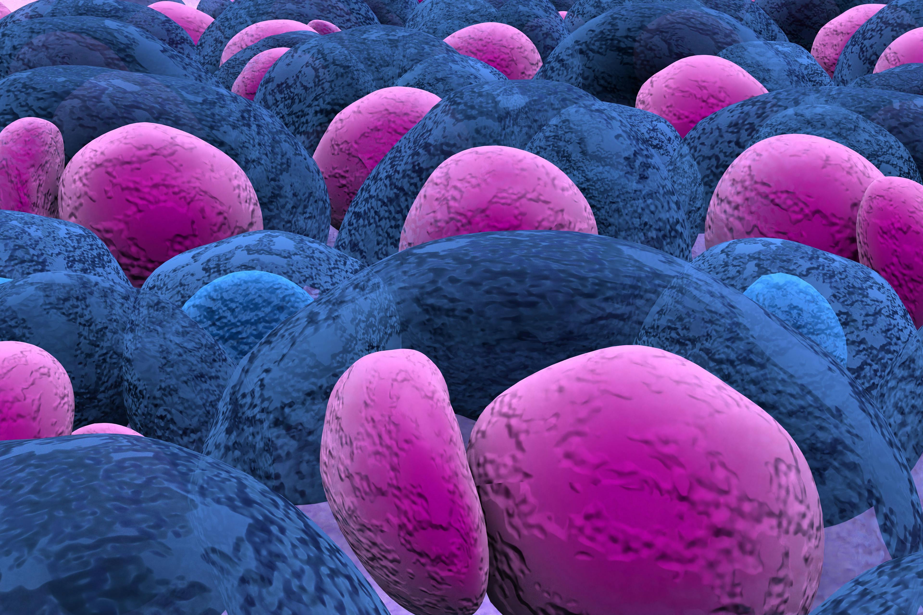 Multiple Myeloma multiplex leukemia cancer 3d color render illustration closeup. Image credit: LASZLO | stock.adobe.com