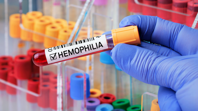 FDA Approves Pfizer’s Beqvez for the Treatment of Adults with Moderate to Severe Hemophilia B