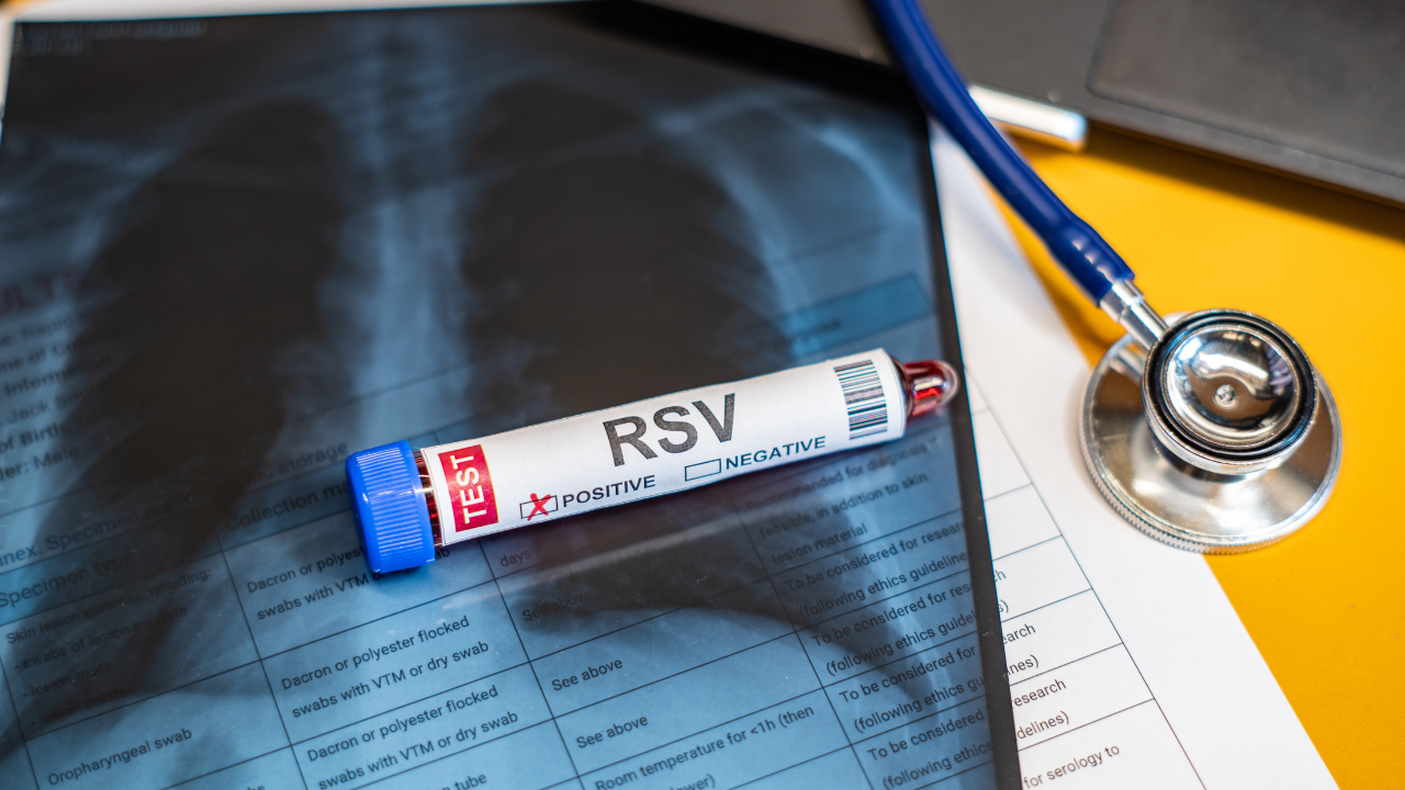 Blood collection tubes Respiratory syncytial virus(RSV) test positive results,medical concept. Image Credit: Adobe Stock Images/JUN LI