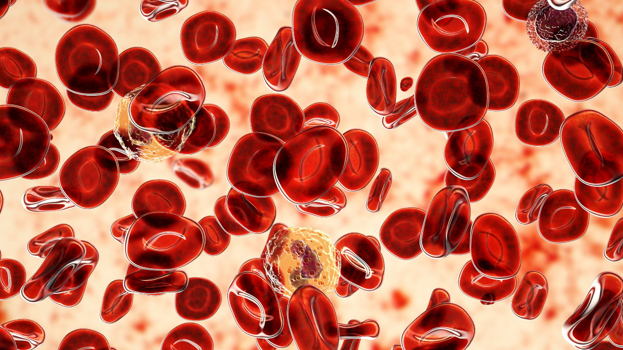 Polycythemia vera, a rare slow-growing blood cancer with an increase in the number of red blood cells. Image Credit: Adobe Stock Images/Dr_Microbe