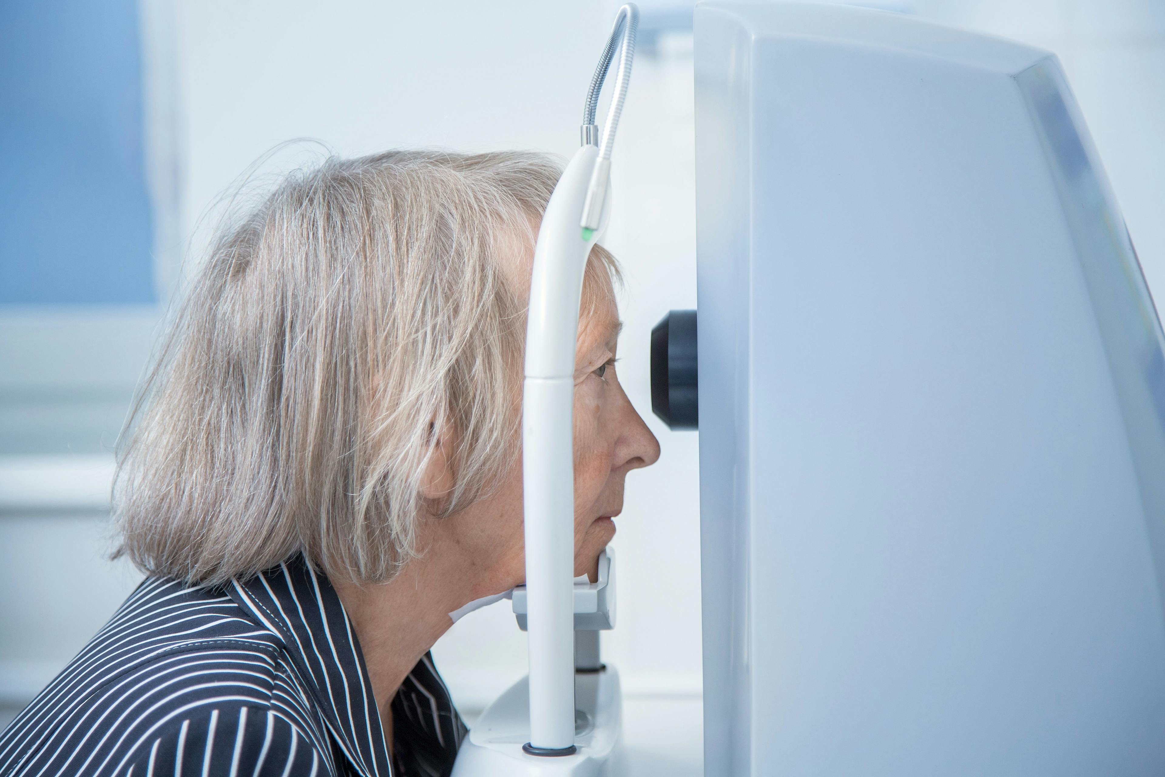  Licensed   FILE #:  536976248  Preview Crop  Find Similar DIMENSIONS 5760 x 3840px FILE TYPE JPEG CATEGORY People LICENSE TYPE Standard or Extended an elderly woman on a computer tomograph does a retinal tomography in the oculist's office. Image Credit: Adobe Stock Images/Olga