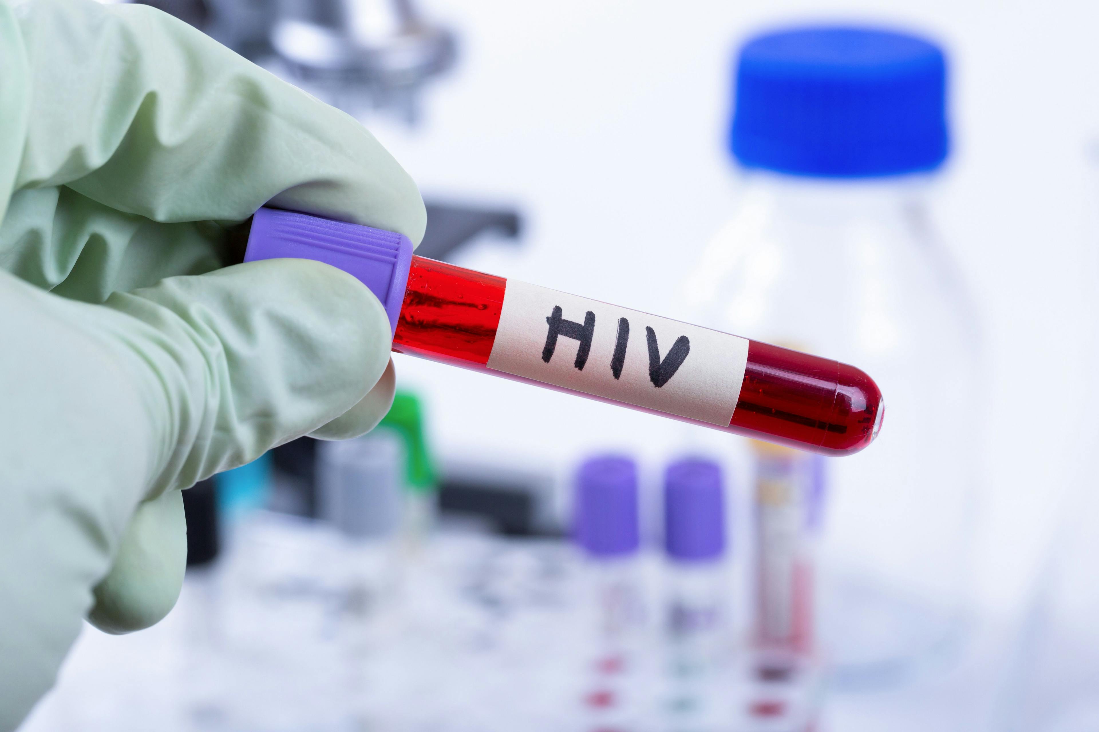 Report: Experimental HIV Vaccine Unlikely to be Effective in Preventing Acquisition 
