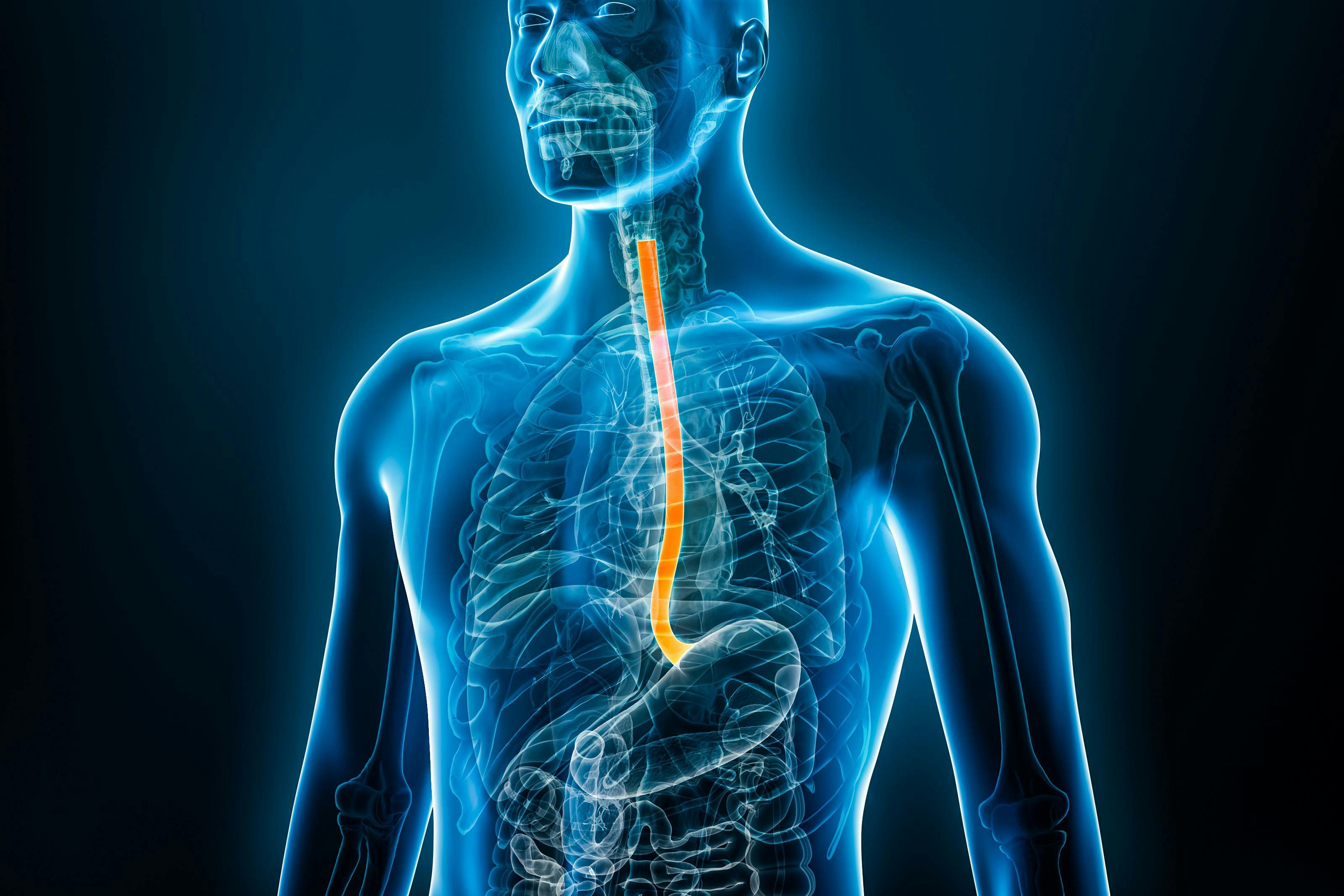 Image credit: Matthieu | stock.adobe.com. Xray front view of the esophagus or oesophagus 3D rendering illustration with male body. Human organ anatomy, esophagitis, digestive system, medical, biology, science, medicine, healthcare concepts.
