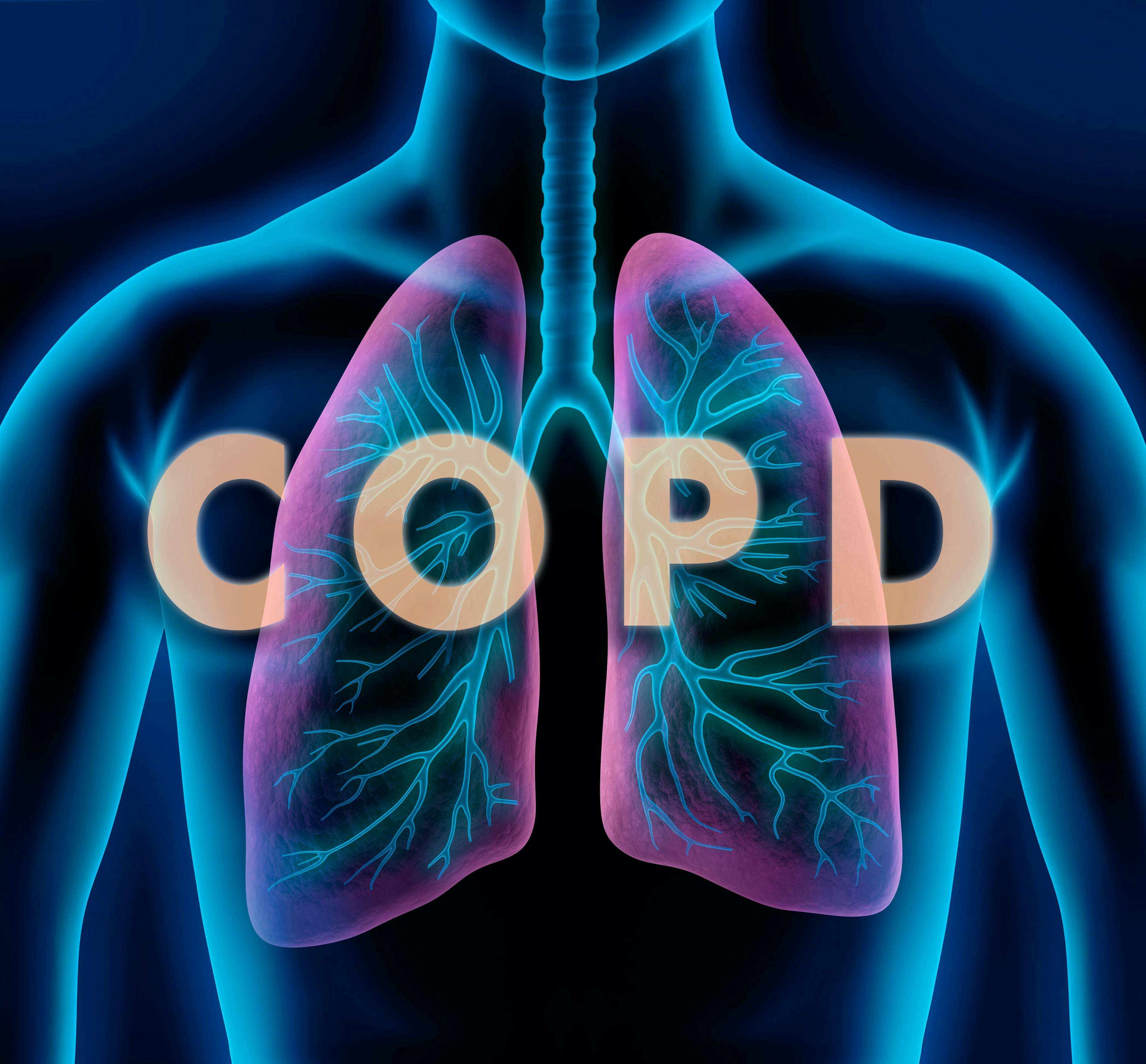 Image credit: peterschreiber.media | stock.adobe.com. Motiv COPD - Lunge und Bronchien