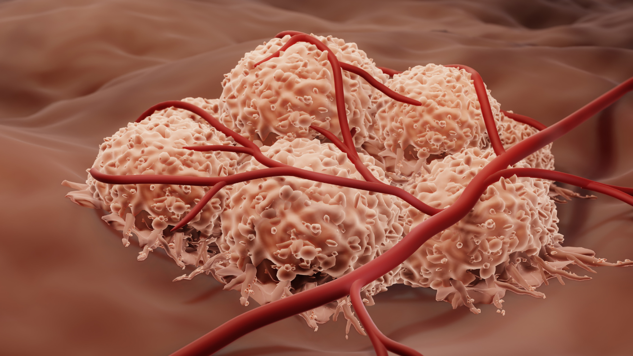 Blood supply to cancer cells. Image Credit: Adobe Stock Images/Artur