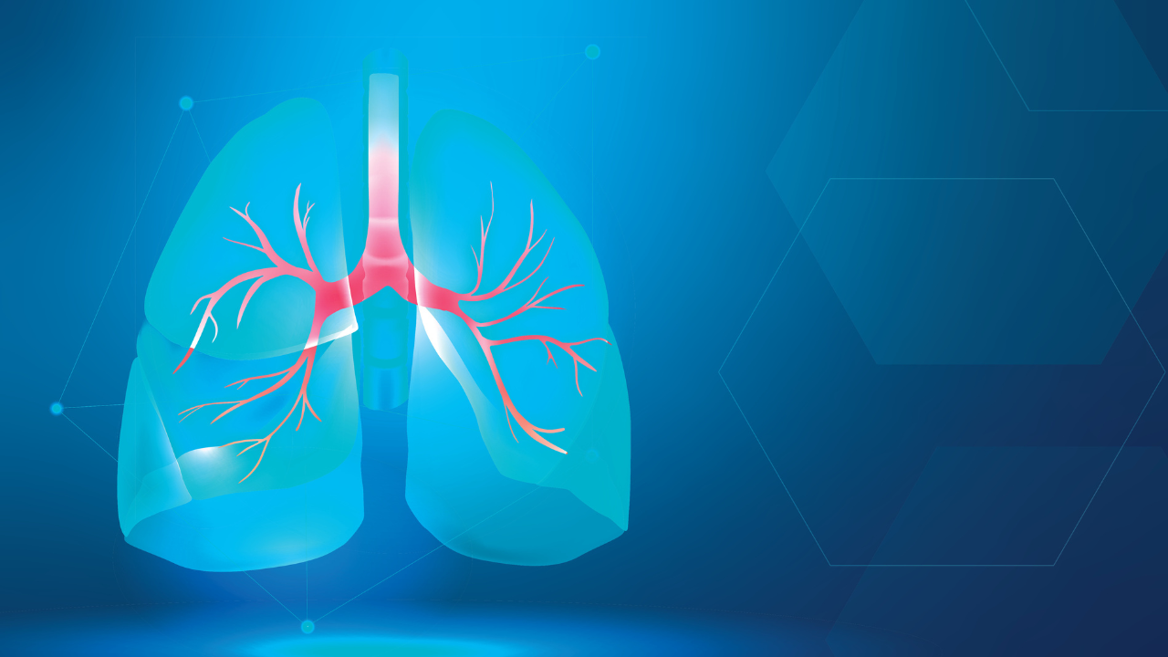 FDA Grants Accelerated Approval to Amgen’s Imdelltra for the Treatment of Adults with Extensive-Stage Small Cell Lung Cancer 
